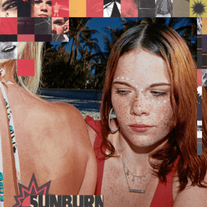 sunburn- dominic fike